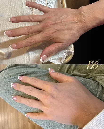 Before and after