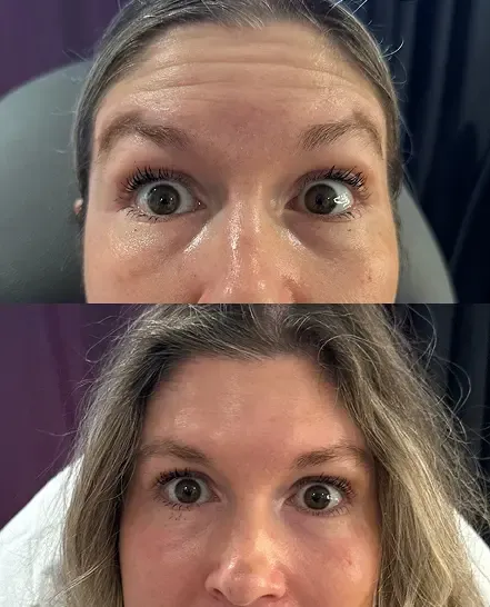 Before and after