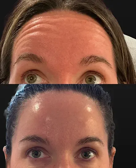 Before and after